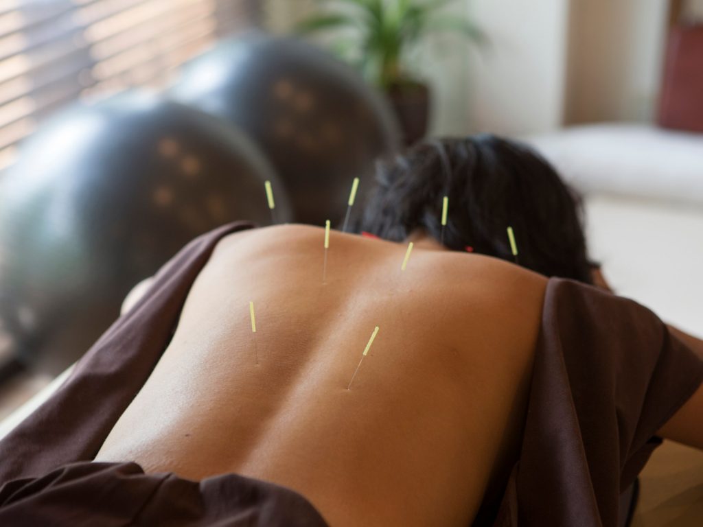 Nature Acupuncture